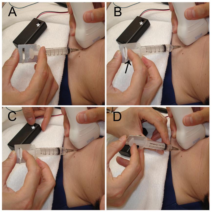 Application of a Novel Vibrating Device for Fine-Needle Aspiration Cytology