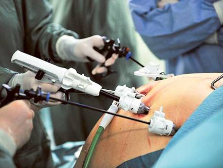 The Long Term Efficacy of an Intensive Lifestyle Intervention versus Bariatric Surgery to Treat Morbid Obesity in Women