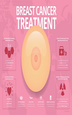 Fabrication of Paclitaxel and 17AAG-loaded Poly-ɛ- Caprolactone Nanoparticles for Breast Cancer Treatment