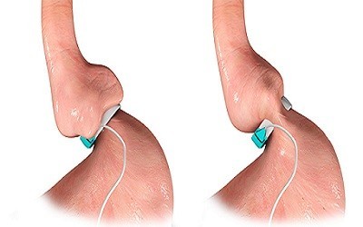 Fabrication of a Novel Device Containing Famotidine for Gastro Retentive Delivery Using Carbohydrate Polymers