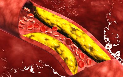 Synthesis of Azopolymer for Colon Targeted Drug Release