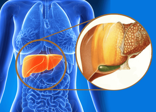 Cisplatin Loaded Liposome Nanoparticles and its Efficacy on the Hepatocellular Carcinoma: An in vitro Study