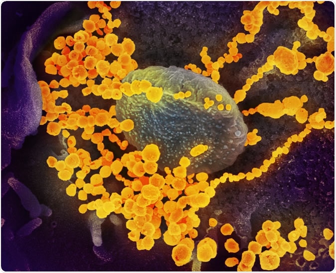 Hydroxychloroquine in the Treatment of COVID 19