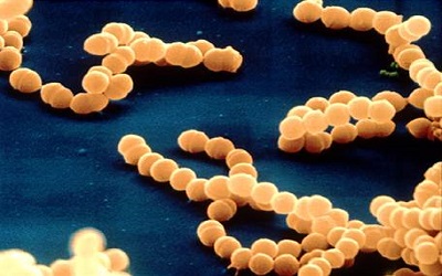 Antibacterial Activity of Selected Essential oils against Streptococcus sobrinus and Porphyromonas gingivalis