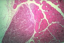 Formulation Characterization of Parathyroid Hormone PTH (1-34)Coated on a Novel Transdermal Microprojection Delivery System:Water Determination