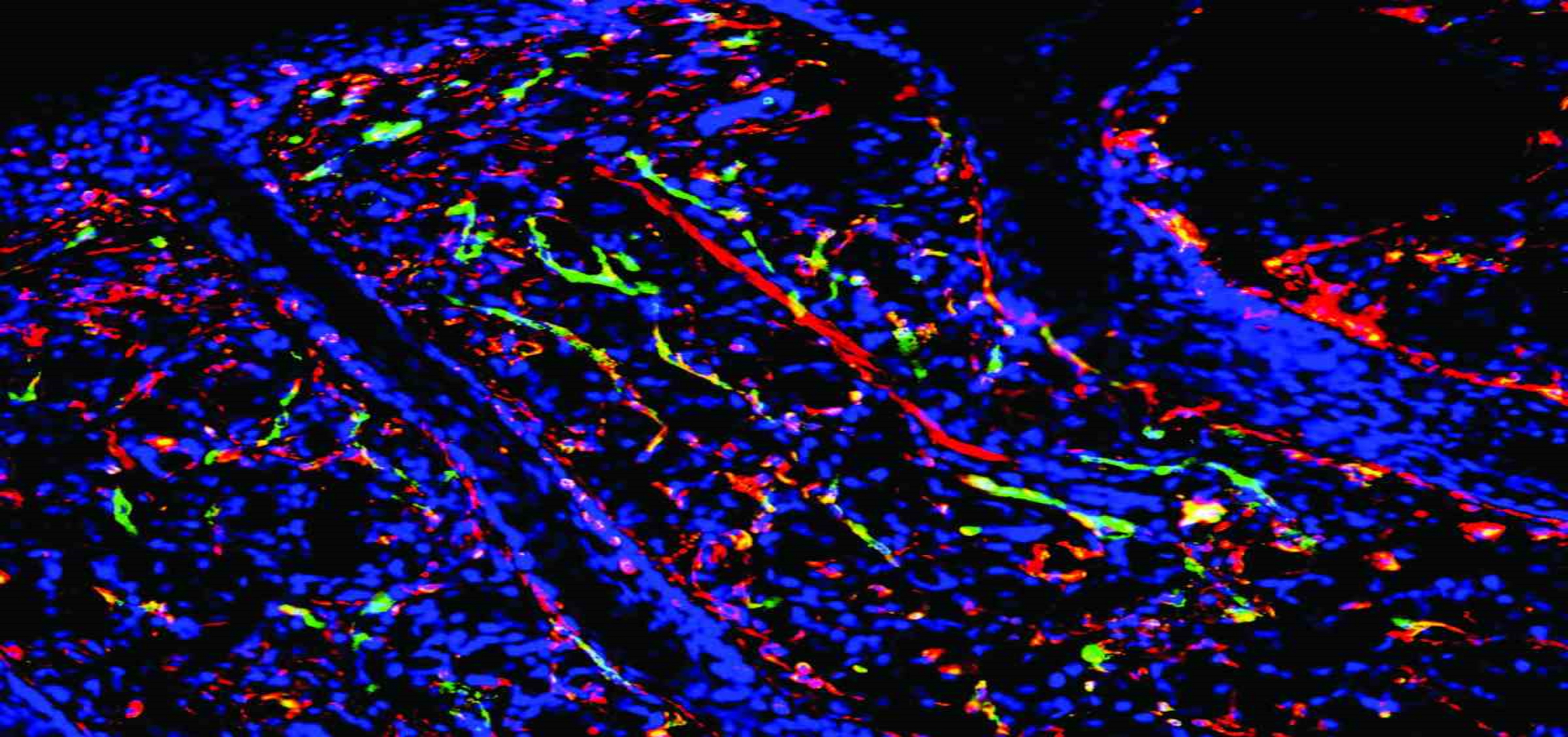 Quercetin Ameliorates Chronic Type 2 Diabetes Induced by Long-Term High-Fat, High-Sucrose Diet via Modifying Expression of Genes Involved in Energy Homeostasis and Inflammation