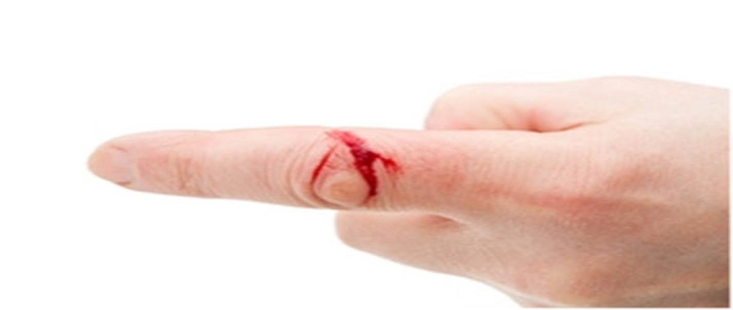 A Comprehensive Overview on Wound Healing and itâ€™s Faster Curative Progression