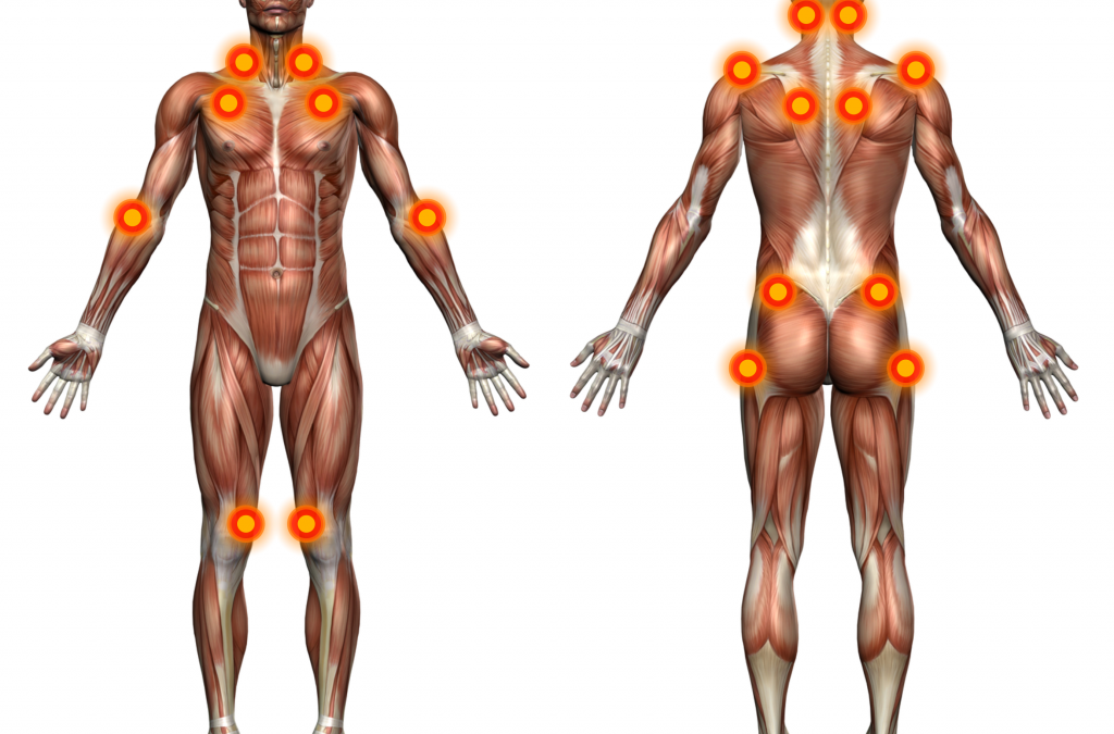 Fibromyalgia Nosography and Therapeutic