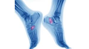 kinesiology
