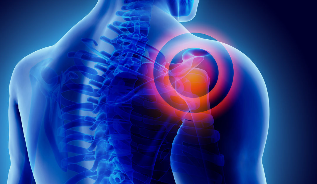 Examination and Conservative Management of Shoulder Pain:A Systematic Tissue Specific Approach