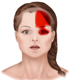 Inter-Rater Reliability for a Recently Developed Cluster of Headache Assessment Tests