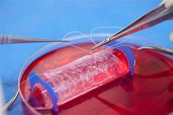 Tissue Engineering Is A Biomedical Engineering Method by Using the Combinations of Material Methods