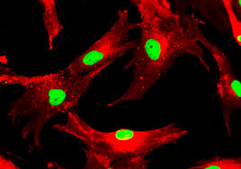 Mesenchymal Stem Cells