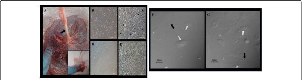 Human Mesenchymal Stem Cells seeded in 3D Collagen Matrix Scaffolds as a Therapeutic Alternative in Tissue Regeneration