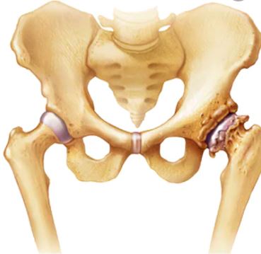 Regenerative Therapies: Osteoarthritis of the Knee