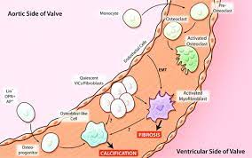 Valvular Cells Resembling Hematopoietic