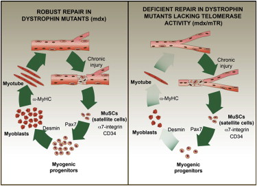 Regenerative Potential of Stem Cells for Duchenne Muscular Dystrophy