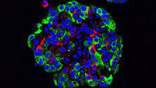 Long Term Preservation of Human Pancreatic Slices as a Model to Analyse Different Therapeutic Development For Pancreatic Islets Regeneration