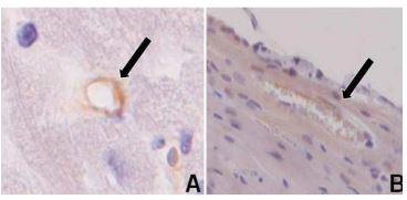 Intravenous Administration Of Stembells in The Acute Phase After Myocardial Infarction Reduces The Pro-Inflammatory Status Of The Intramyocardial Vasculature in A Rat Model