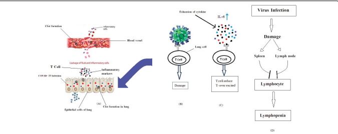 Sense the Smell of Beginning of Cytokine Storm: A Report on Study of Early Markers of the Complications