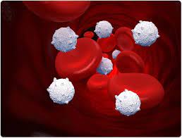 Bone Marrow Derived Cell Therapy for Critical Limb Ischemia in Hematopoietic Stem Cell