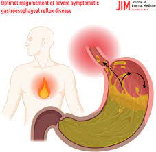 Regenerative Medication Techniques for the Treatment of Oesophageal Sickness