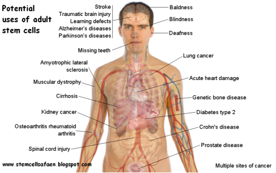 Stem Cells and Management of Healthcare Costs: Stem Cell-Based Treatments and the Societal Balance Sheet