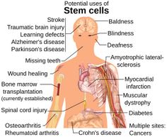 Suspended Life - Stem Cells: Are Treatments Possible?