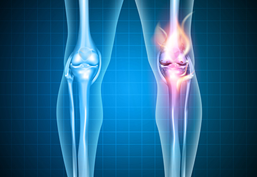 Similar 48-H Analgesic Effects of Pre Vs. Post-Operative Pregabalin in Orthopaedic Oncological Patients: A Randomised Double-Blind Placebo-Controlled Trial