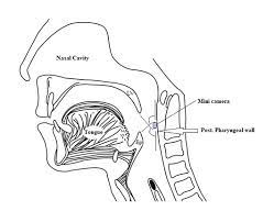 Visuals of Upper Respiratory Tract during Physiological Sleep