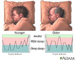 Sleep Changes with Normal Aging and Disordered Sleep in the Older Adults