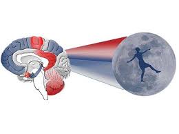 Sleep-Related Hypermotor Epilepsy a Unique Disorder with Heterogeneous Genetic Etiologies