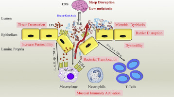 Sleep Quality in Adolescents with Inflammatory Bowel Disease