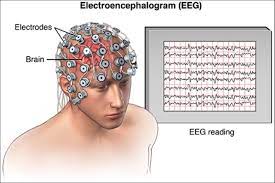 Relevance of Electroencephalogram Assessment in Amyloid and Tau pathology in Rat