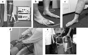 Venous Occlusion Plethysmography in Patients with Post-Thrombotic Venous Claudication