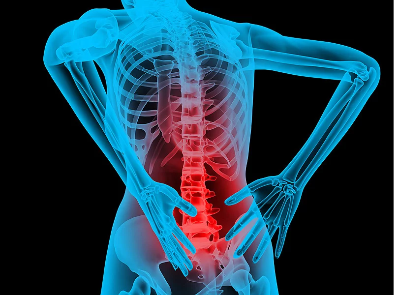 Innovative Treatment For Chronic Lumbar Back Pain