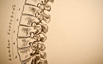 Adjacent Level Degeneration in the Lumbar Spine after Single-Level Fusion versus Arthroplasty: Five-Year Clinical and Radiographic Outcomes