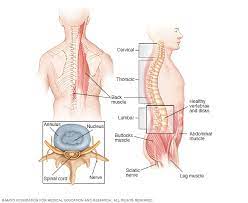 Investigation of Mind and Spinal Rope Neoplasms