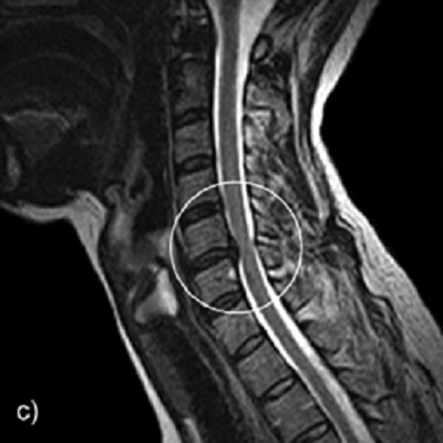 Kinematic Cervical Spine MRI in Low-Impact Trauma
Assessment - Review and Application in Clinical Practice