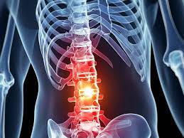 Spinal Cord Injuries: Recognition and Implications