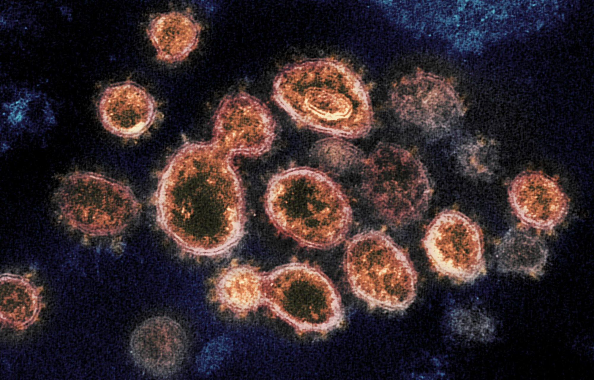 Severe Acute Respiratory Syndrome Affected by COVID-19