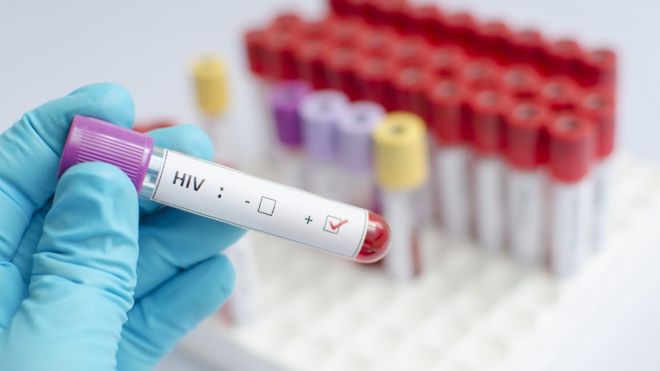 Broadly Neutralizing Antibodies between HIV Vaccination and Treatment the Beginning of the End?