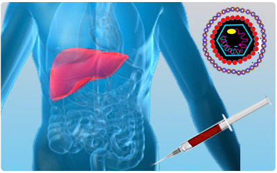 Prevalence of Hepatitis Virus and HBV/HCV Interactions in Opiate Addict Subjects