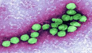 Towards a West Nile Virus Vaccine