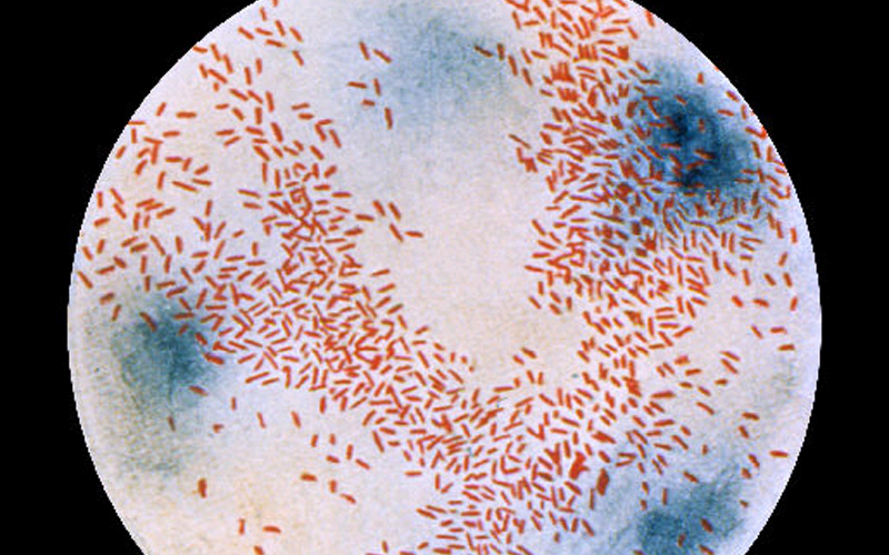 Antigenic Complementarity between Influenza A Virus and Haemophilus influenzae may Drive Lethal Co-Infection Such as that Seen in 1918-19 Pandemic