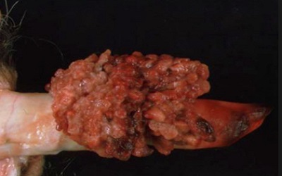Retrospective Study of Some Tumors at the  Genital Tract of Dogs