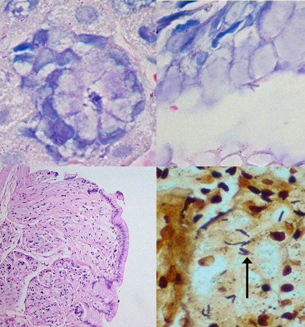 Barrettâ€™s Disease and Helicobacter Spp. Detection in Dogs with Gastritis