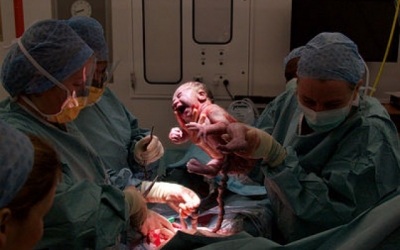 When Patients Request the Knife Cesarean Delivery on Maternal Request