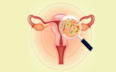 Comparison of Metronidazole versus a Combination of Metronidazole plus Probiotics in the Treatment of Bacterial Vaginosis