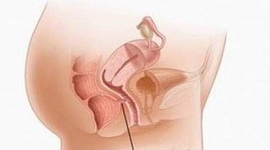 Impacts of Treatment Practices Among Vesicovaginal Fistula Patients and Practitioners in Nigeria: Fulbright Supported Study, March 2014 ï¿½ December 2014